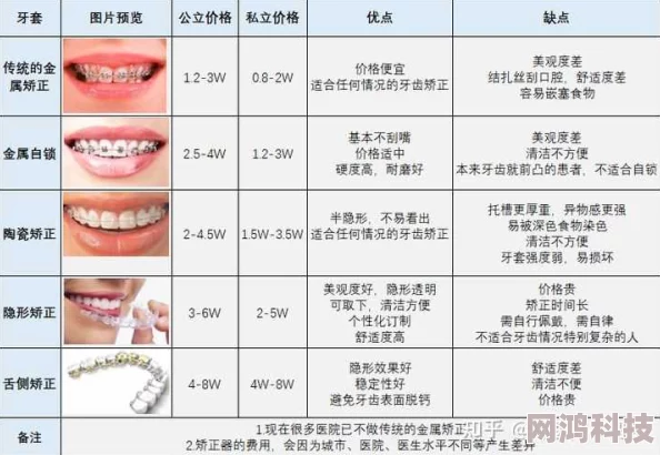 神仙道龅牙正畸费用揭秘：牙套及治疗费高达数万元不等！