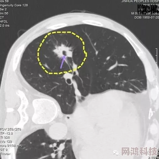 黄色软件在线下载风险与安全隐患需谨慎甄别来源保护个人信息