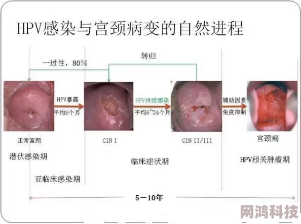 女的用嘴巴吃鸡会得HPV此说法缺乏科学依据HPV主要通过性接触传播